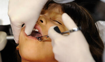 Countries agree to end mercury tooth fillings by 2034